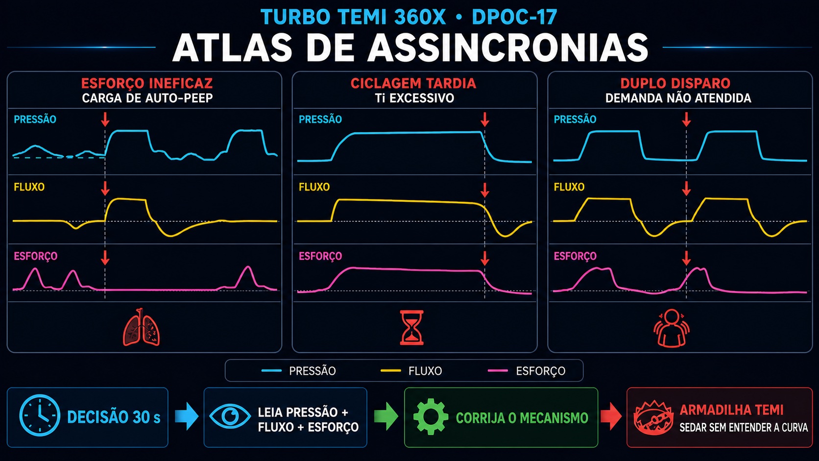 Atlas Turbo TEMI de assincronias ventilatórias com curvas simultâneas de pressão, fluxo e esforço para reconhecer esforço ineficaz, ciclagem tardia e duplo disparo.
